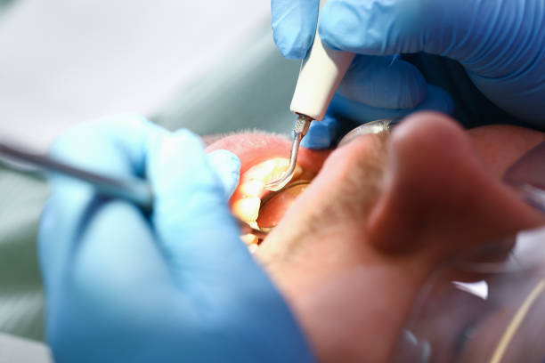 Best Weekend Emergency Dentist in Timpson, TX
