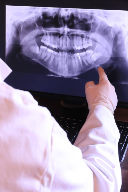 Best Emergency Dental Care for Abscessed Tooth in Timpson, TX