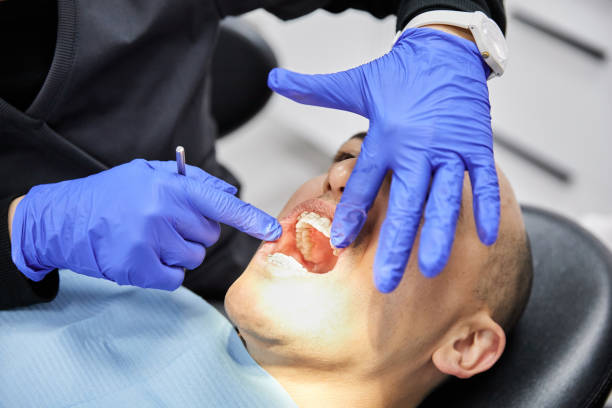 Best Emergency Dental Extractions in Timpson, TX